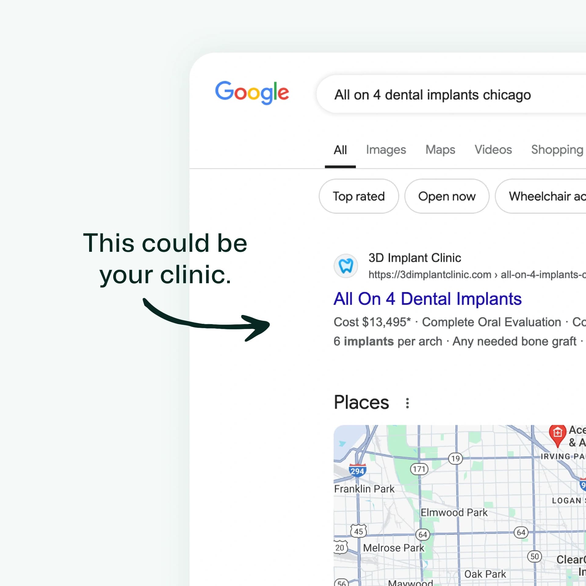 Dental SEO analytics dashboard preview